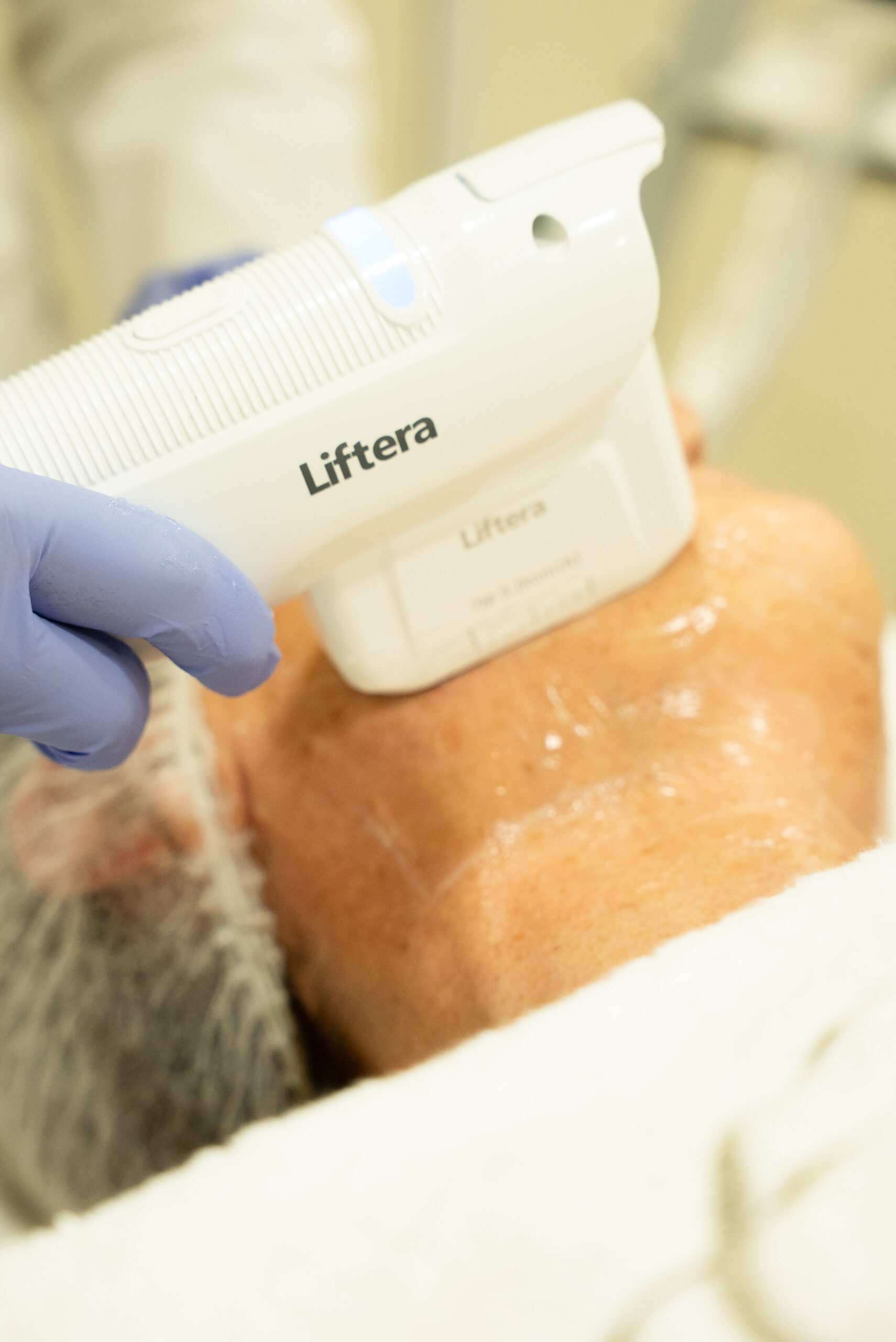 HIFU LIFTERA